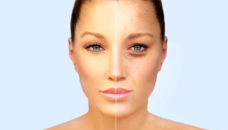 ارتباط لوازم آرایش و مشکلات پوستی