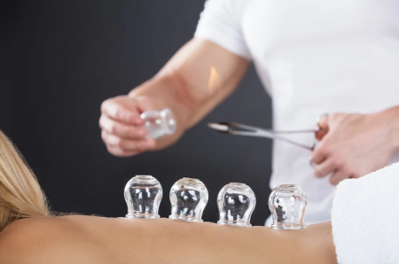 حجامت برای درمان جوش