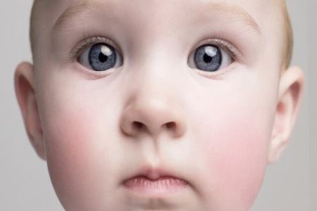 زوال عقل،اخبار پزشکی،خبرهای پزشکی