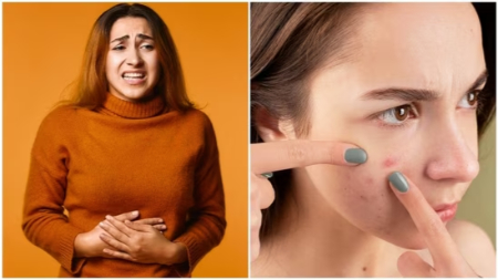 چگونه سلامت روده بر پوست تاثیر می‌گذارد