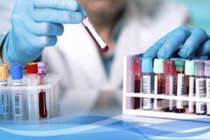 فعالیت ۴۱ آزمایشگاه تشخیص طبی در همدان